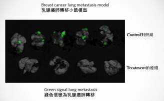 圖中顯示使用「YB1」治療乳腺癌肺轉移小鼠的情況，上方的綠色信號為對照組小鼠乳腺癌肺轉移的情況，而下方治療組小鼠以「YB1」治療後則沒有出現肺轉移，可見「YB1」能完全抑制腫瘤的肺轉移。