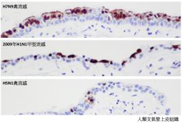 圖片顯示人類支氣管上皮組織，研究人員比較了甲型禽流感（H7N9）病毒，2009年甲型流感（H1N1）病毒（俗稱豬流感）、以及高致病性甲型禽流感（H5N1）病毒在體外培養的人類支氣管組織的感染能力。 圖中棕色部分顯示被病毒感染的細胞，藍色部分顯示非感染的細胞。H7N9病毒能導致廣泛支氣管上皮細胞感染，情況與2009年的甲型流感（H1N1）病毒相似。相反，H5N1病毒只能作出有限度感染。 