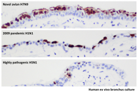 The image shows human ex vivo bronchus culture, research team compared the extent of virus infection with the avian influenza A (H7N9) virus, the 2009 pandemic influenza A (H1N1) virus (commonly known as swine influenza) and highly pathogenic avian influenza A (H5N1) virus in the human bronchus tissues cultured ex vivo. The part with brown color shows virus infected cells and the blue indicates non infected cells. H7N9 virus leads to extensive infection of the surface cells (epithelium) of the bronchus, comparable to the 2009 pandemic virus.  In contrast, the H5N1 virus only infects occasional bronchial epithelial (surface) cells. 