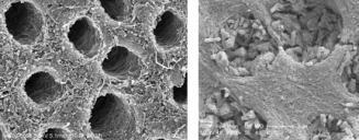掃瞄式電子顯微鏡顯示塗上聚多巴胺的象牙質的微細管道(左)在經過再礦化後舖滿了結晶體(右)。