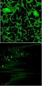 三種口腔細菌混合一起形成的生物膜（上圖），放入氯己定納米顆粒溶液後，生物膜沒有形成（下圖），被染成綠色的存活細胞顯示在共聚焦激光掃描顯微鏡*
