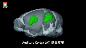 audio cortex