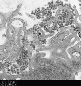 電子顯微鏡下的中東呼吸綜合症病毒。