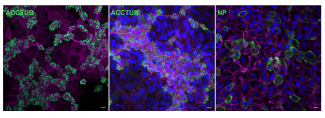 共聚焦顯微鏡圖像顯示二維的成熟呼吸道類器官中的纖毛細胞（左和中圖的綠色細胞）及被H7N9病毒感染的細胞（右圖中的綠色細胞）。藍色和紫色分別代表細胞核和細胞肌動蛋白。