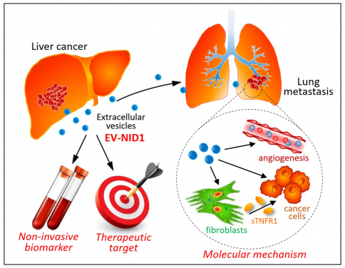 A research team at LKS Faculty of Medicine, The University of Hong Kong (HKUMed) discovered that the liver cancer cell-derived extracellular vesicles (EVs) promote tumour growth and metastasis to lungs. The novel findings of the tumour-derived extracellular vesicles provide insights into promising biomarker and new therapeutic approach for liver cancer.
 