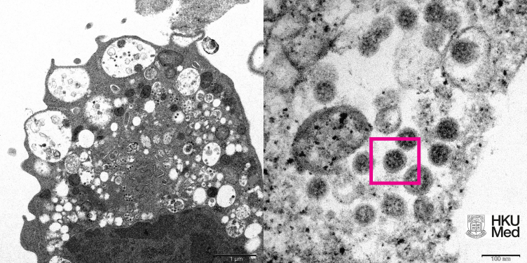 HKUMed reveals the electron microscope image of SARS-CoV-2 Omicron variant 