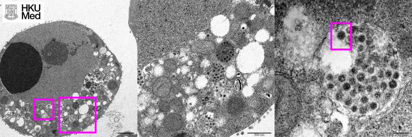 左圖：低倍電子顯微鏡下感染新型冠狀病毒 Omicron 變異株 24 小時後的猴腎細胞（Vero）。方框內顯示細胞質中的病毒顆粒聚集體。
中圖：高倍電子顯微照片顯示，左圖大方框內囊泡裡的病毒顆粒聚集體和細胞表面上的病毒顆粒。
右圖：左圖小方框內擁有刺狀的病毒顆粒經高倍電子顯微鏡放大後的影像。
圖片由香港大學李嘉誠醫學院（港大醫學院）病理學系臨床教授黎國思教授、公共衞生學院譚華正基金教授（醫療科學）兼病毒學講座教授裴偉士教授、公共衞生學院教授及公共衞生實驗室科學分部主任潘烈文教授，及香港大學電子顯微鏡研究所提供。
下載高清版圖片：https://bit.ly/3EPkKTx