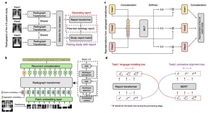 REFERS workflow. Researchers forward radiographs of the k-th patient study through the radiograph transformer, fuse representations of different views using an attention mechanism, and use report generation and study-report representation consistency reinforcement to exploit the information in radiology reports. Graph a, an overview of the whole pipeline. Graph b, the architecture of the radiograph transformer. Graph c, attention for view fusion is elaborated. MLP stands for a multi-layer perceptron. Graph d, two supervision tasks are shown, report generation and study-report representation consistency reinforcement.