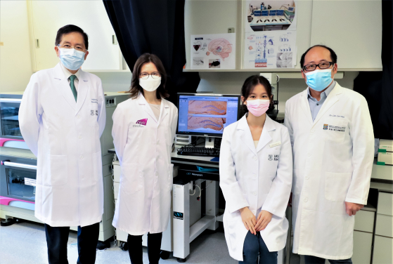 A joint research team from the LKS Faculty of Medicine, The University of Hong Kong (HKUMed) and City University of Hong Kong (CityU) has discovered that the electrical stimulation of the eye surface can alleviate depression-like symptoms and improve cognitive function in animal models. The research team members include (from left): Professor Chan Ying-shing, Dexter H C Man Family Professor in Medical Science, Professor of the School of Biomedical Sciences, Associate Dean (Development and Infrastructure), HKUMed, and Director of the Neuroscience Research Centre, HKU; Dr Leanne Chan Lai-hang, Associate Professor in the Department of Electrical Engineering, CityU; Yu Wing-shan, PhD student, School of Biomedical Sciences, HKUMed and Dr Lim Lee Wei, Assistant Professor of the School of Biomedical Sciences, HKUMed.