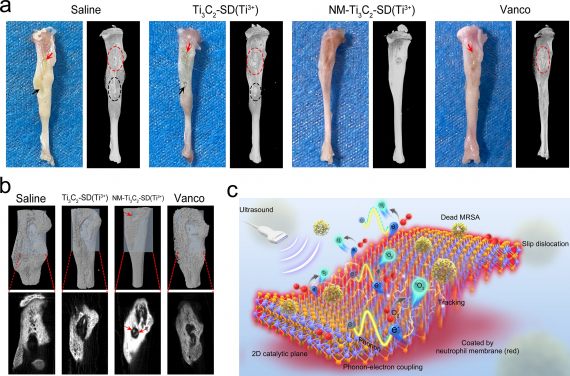 Treatment efficacy:
Animal models with bone tissue infection: 
a) Macroscopic images of infected tibia specimens of mice after 14 days of different treatments. With the use of NM-Ti3C2-SD(Ti3+) nano-sheets (NM-nano-sheets), bony tissue infection has been controlled and no deformity of bone has been found.

b) Three-dimensional reconstruction CT images (top, indicated by the light blue areas) and the μ-CT 2D images of the corresponding sections (bottom) of harvested bone tissues. The bone tissue treated by NM-nano-sheets was completely healed. After 14 days of treatment, new bone tissue has formed at the defect area (indicated by red arrow).

c) Schematic diagram of NM-nano-sheets releasing reactive oxygen species (1O2) and tracking MRSA bacteria.
