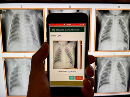 Students are engaged in exercises, using an App developed by HKUMed and their own smartphones to detect and differentiate patients’ chest x-rays with and without pneumonia, such that they could better understand the principles of data labelling and machine learning.
 